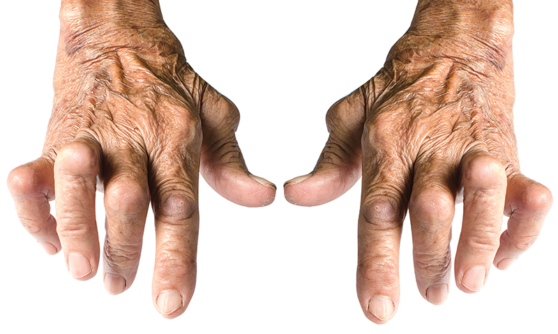 Myths about Methotrexate